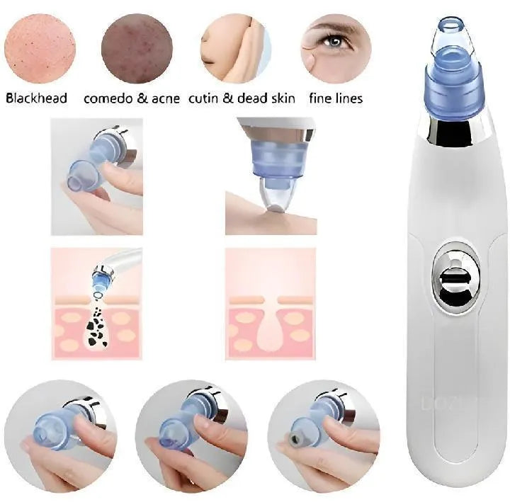 Easy Cleaning Derma Suction Facial Cleanser